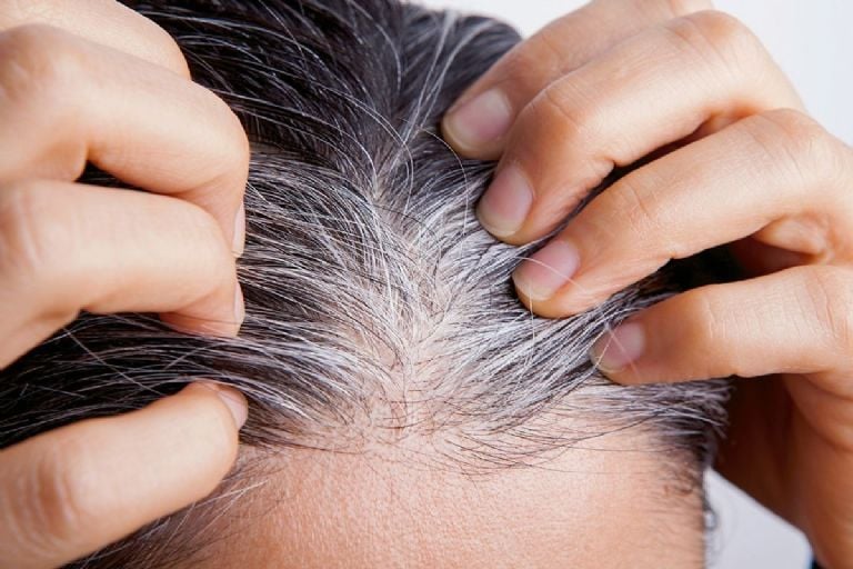 Canas en el cabello.