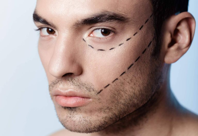 Medicina estética masculina; tendencias emergentes y enfoques personalizados