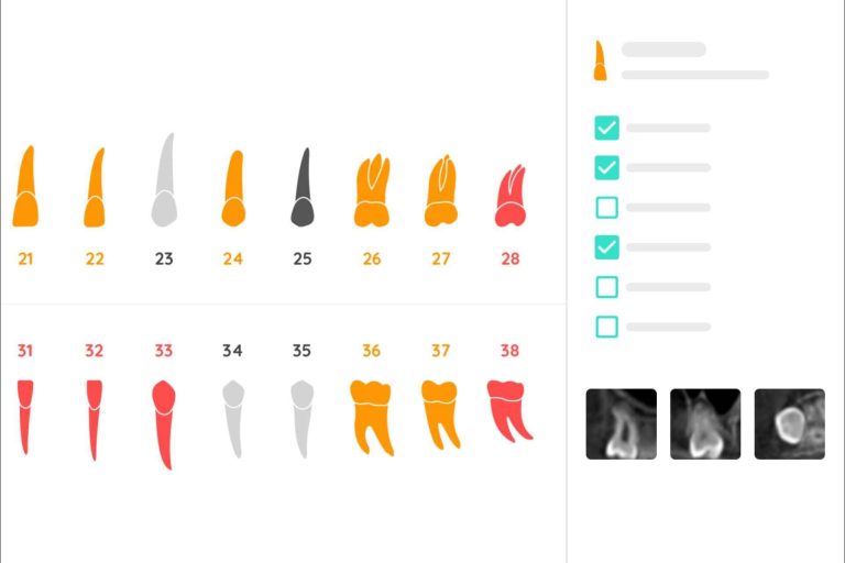 La revolucionaria solución en forma de software para dentistas potenciado por inteligencia artificial de Dentomo