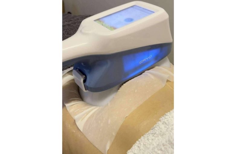 Comenzar la operación bikini de Sleimy con sus tratamientos corporales