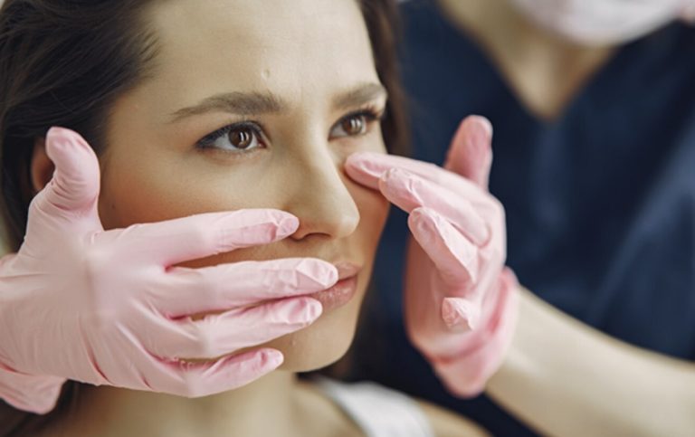 Rinoplastia: lo que necesitas saber sobre la cirugía estética de la nariz