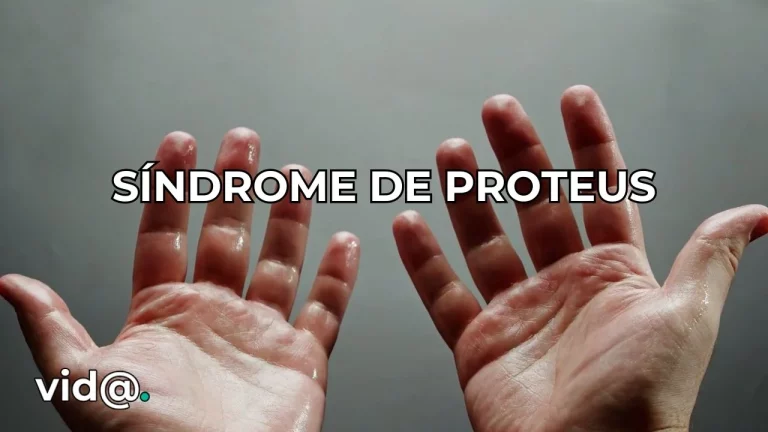 Síndrome de Proteus, qué es y en qué consiste