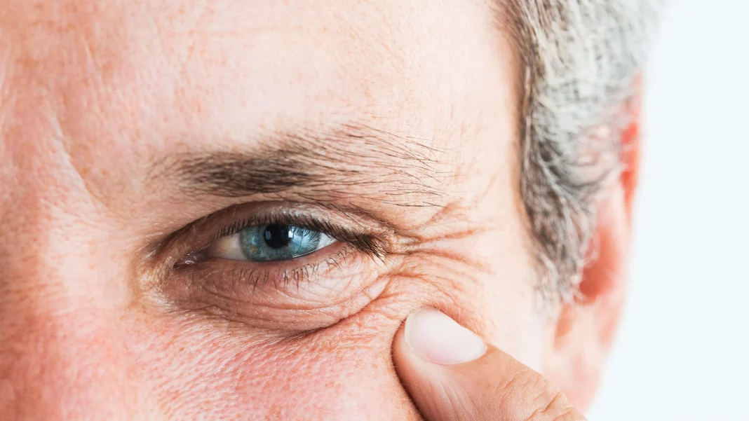 Una composición pensada para combatir bolsas, ojeras y arrugas