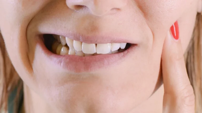 Cómo combatir el bruxismo con remedios caseros