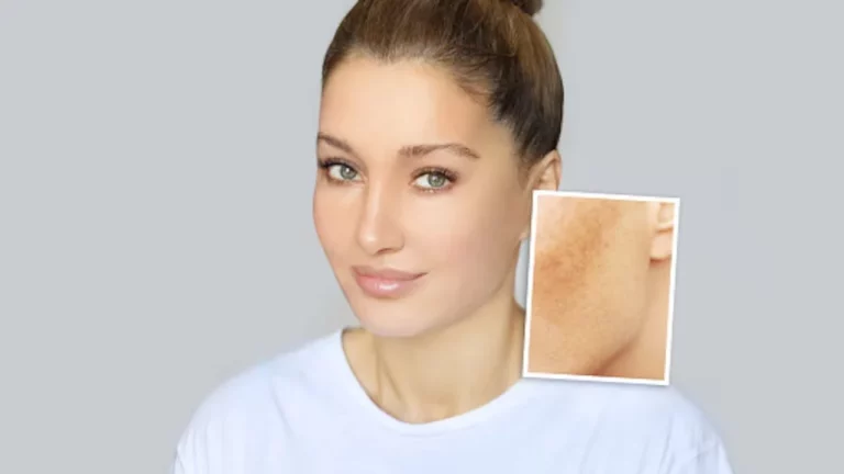 El remedio casero de la abuela para eliminar las manchas de la cara en el verano