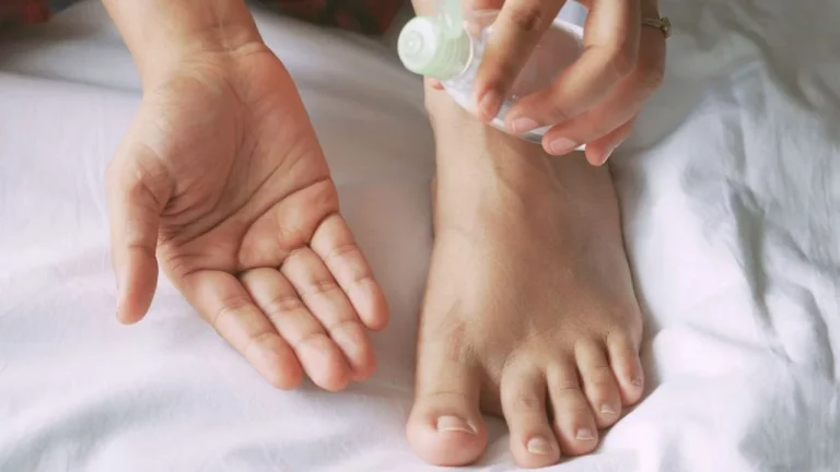 El truco infalible para eliminar los hongos de los pies durante el verano