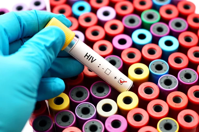 La ciencia vuelve a rozar la vacuna contra el VIH La ciencia vuelve a rozar la vacuna contra el VIH