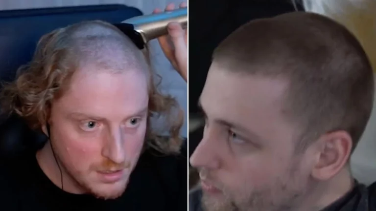 La demostración de que llevar auriculares deforma la cabeza, pero puedes evitarlo así