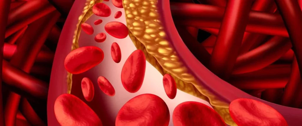 ¿Por qué el colesterol puede encontrarse de esta manera?