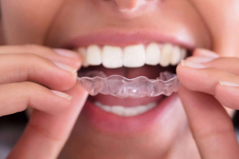 Sonreír con tranquilidad; la importancia de tener un dentista cerca de casa