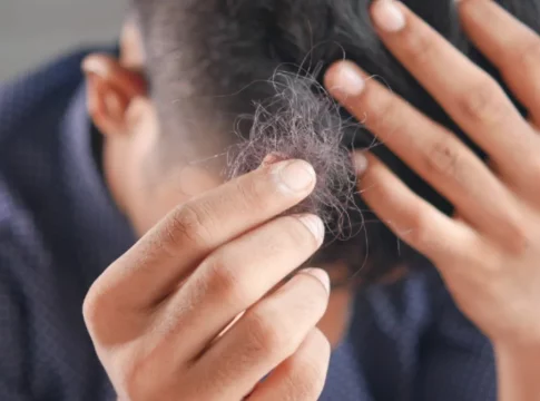 ingrediente-cocina-caida-del-cabello El ingrediente secreto guardado en tu cocina que ayuda a combatir la caída del cabello