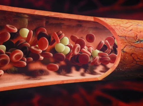 enfermeria Enfermería al rescate: Guía Integral de la Hiperemia y su tratamiento