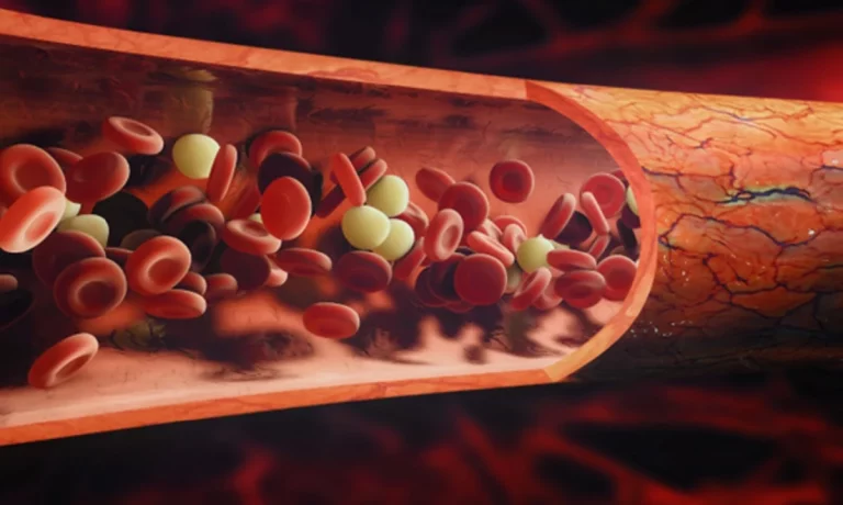 Enfermería al rescate: Guía Integral de la Hiperemia y su tratamiento