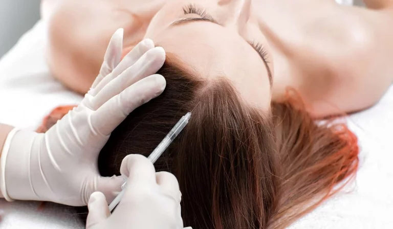 ¿Cuáles son los beneficios de los tratamientos capilares?