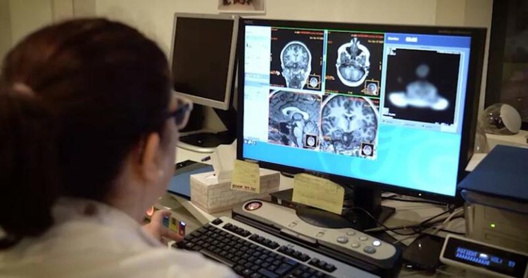 La Medicina Nuclear permitirá elegir a pacientes que se beneficien de las terapias frente al Alzheimer