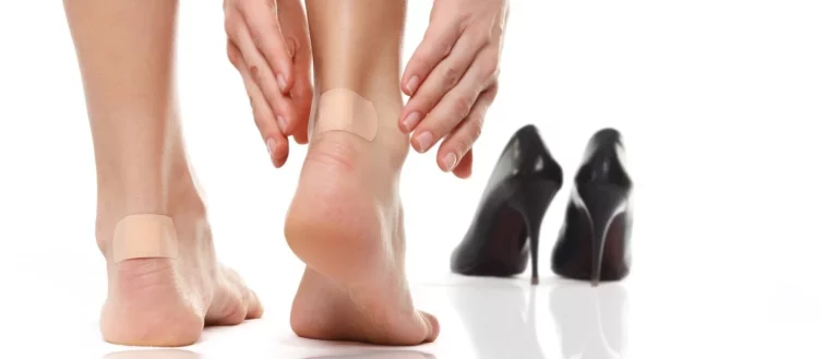 3 remedios de las abuelas para evitar las molestas rozaduras en los pies