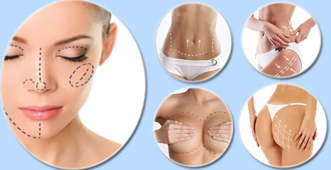 Top 5 de las cirugías estéticas más solicitadas en España