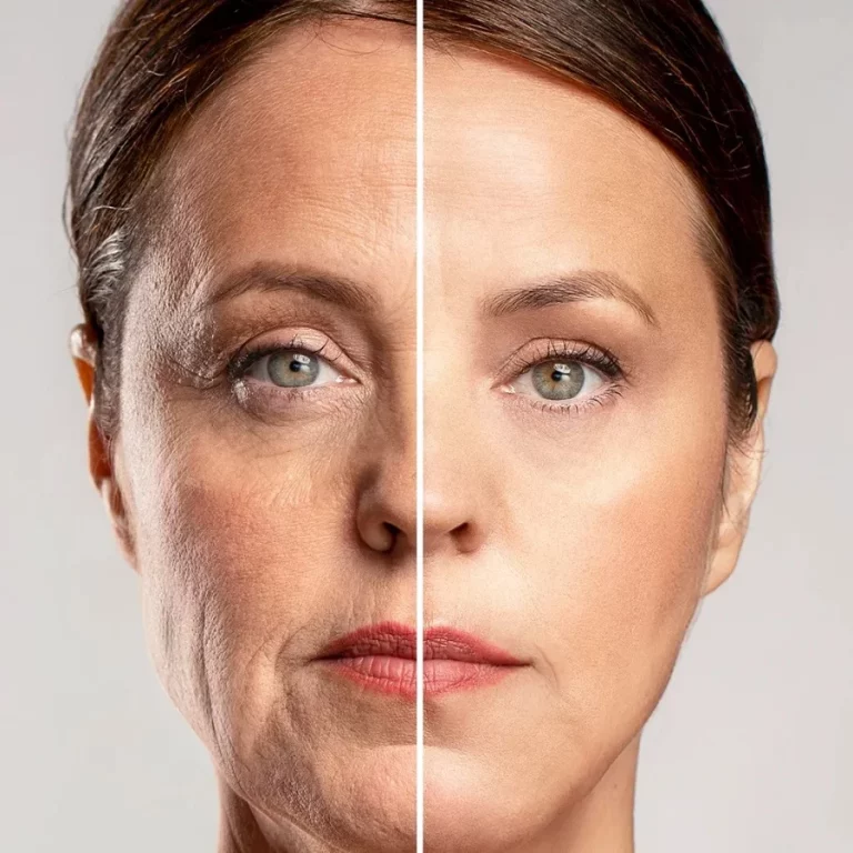 Ácido hialurónico: cómo actúa