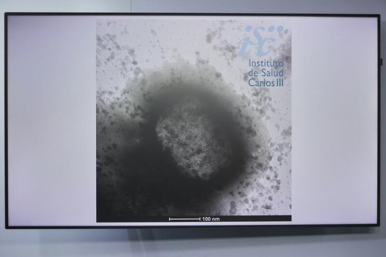  Castilla y León registra su quinto caso de viruela del mono en 2024, un brote que impacta en Salamanca