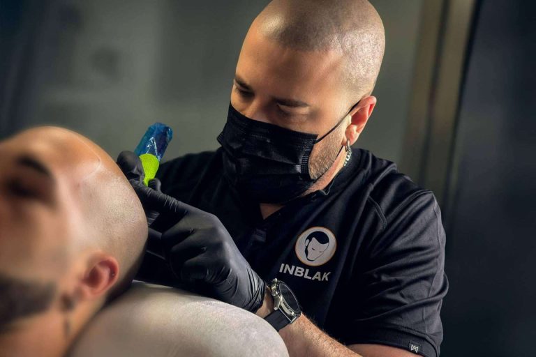 INBLAK se consolida como referente en micropigmentación capilar en España