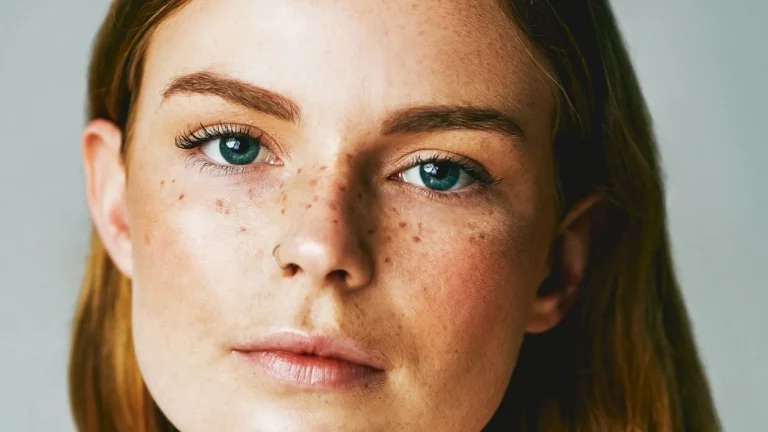 Atento al ‘freckling’, la nueva moda de tatuarse como un filtro de Instagram