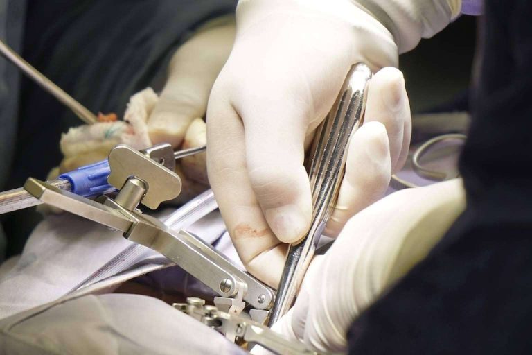 Mejorar la calidad de vida en personas mayores con cirugía de columna es una solución segura