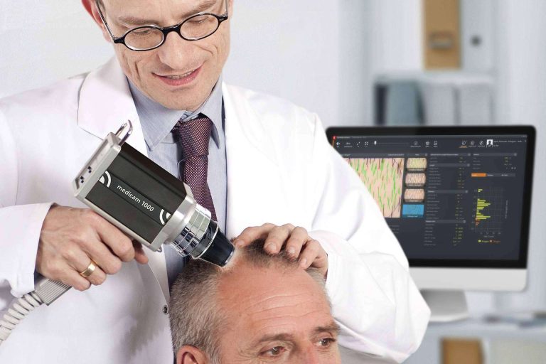 Creciente caída del cabello en España; soluciones tecnológicas que transforman el diagnóstico capilar