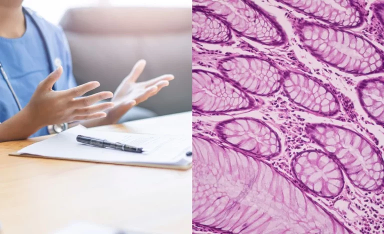 El ICGEA advierte que el retraso en la aprobación de terapias oncológicas en España compromete la supervivencia de pacientes