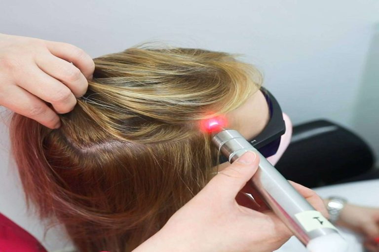 Tratamiento capilar con Exosomas, la regeneración capilar ha llegado para quedarse