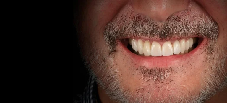 Encías inflamadas y rojas: el primer aviso antes de la recesión