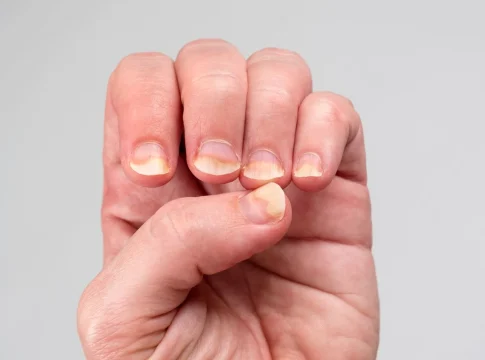 uñas freepik 000