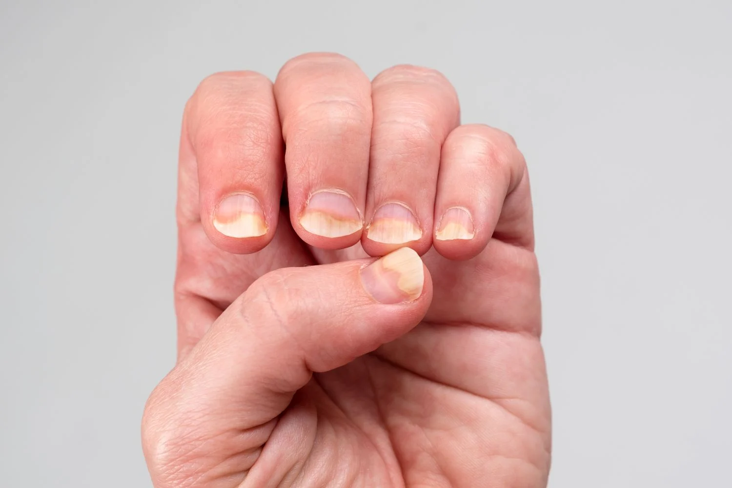 uñas freepik 000