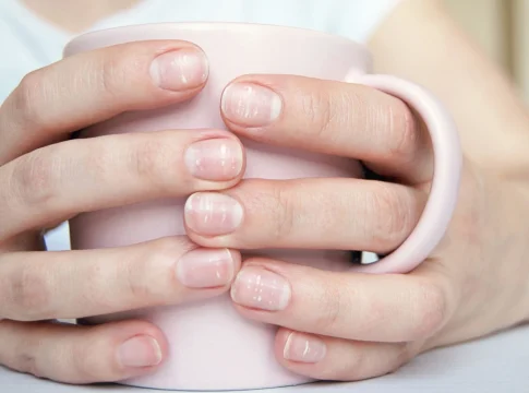 uñas Afirman que este vistazo a tus uñas podría ayudarte a detectar síntomas ocultos de cáncer