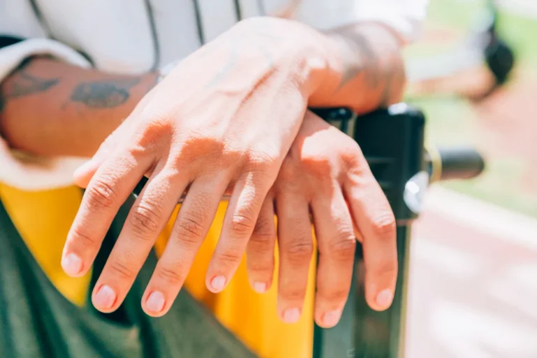 Un médico lo aclara: esta señal en tus uñas puede ser más peligrosa de lo que parece