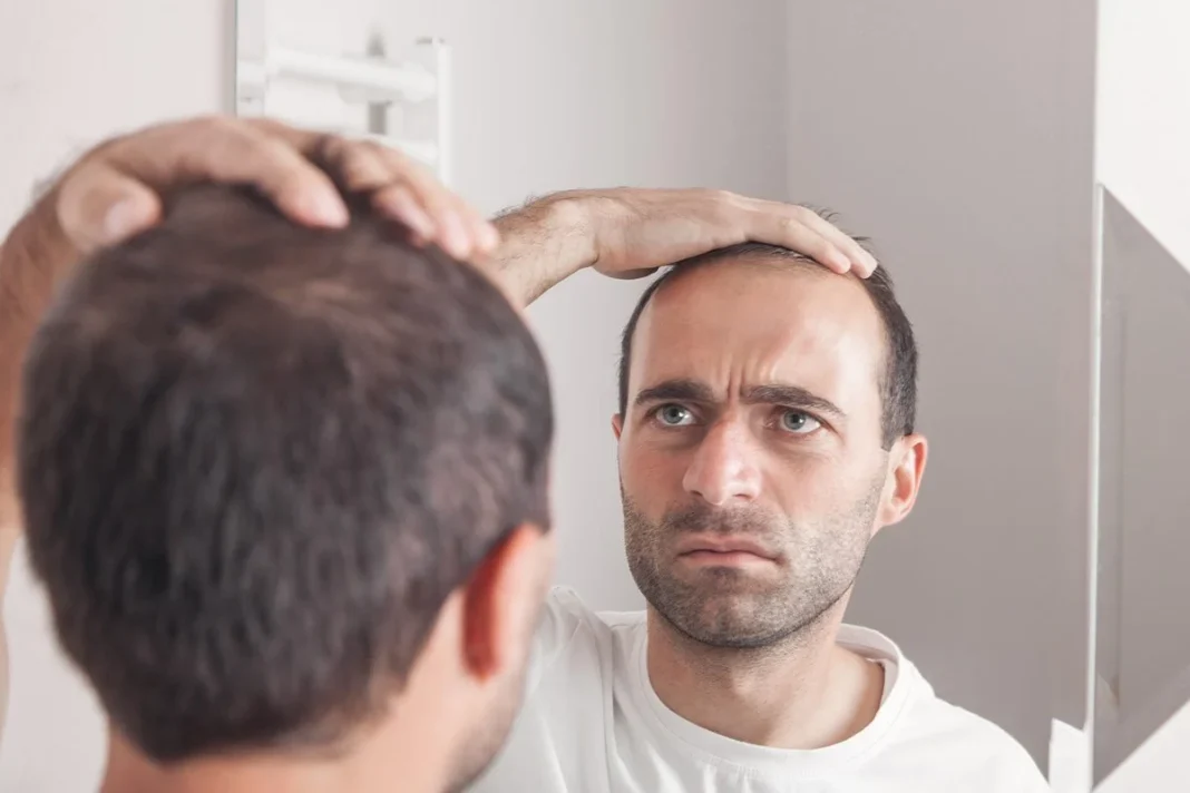 CIENTÍFICOS ESPAÑOLES ABREN NUEVOS CAMINOS FRENTE A LA ALOPECIA