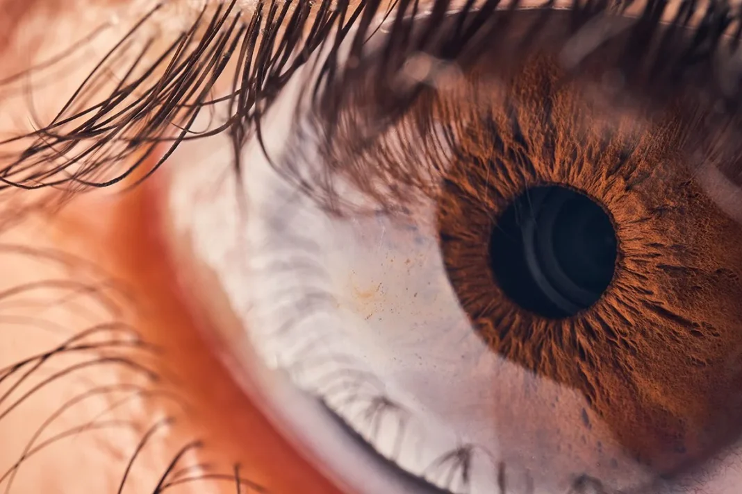 CÓMO FUNCIONA ESTA SOLUCIÓN PARA LA VISTA