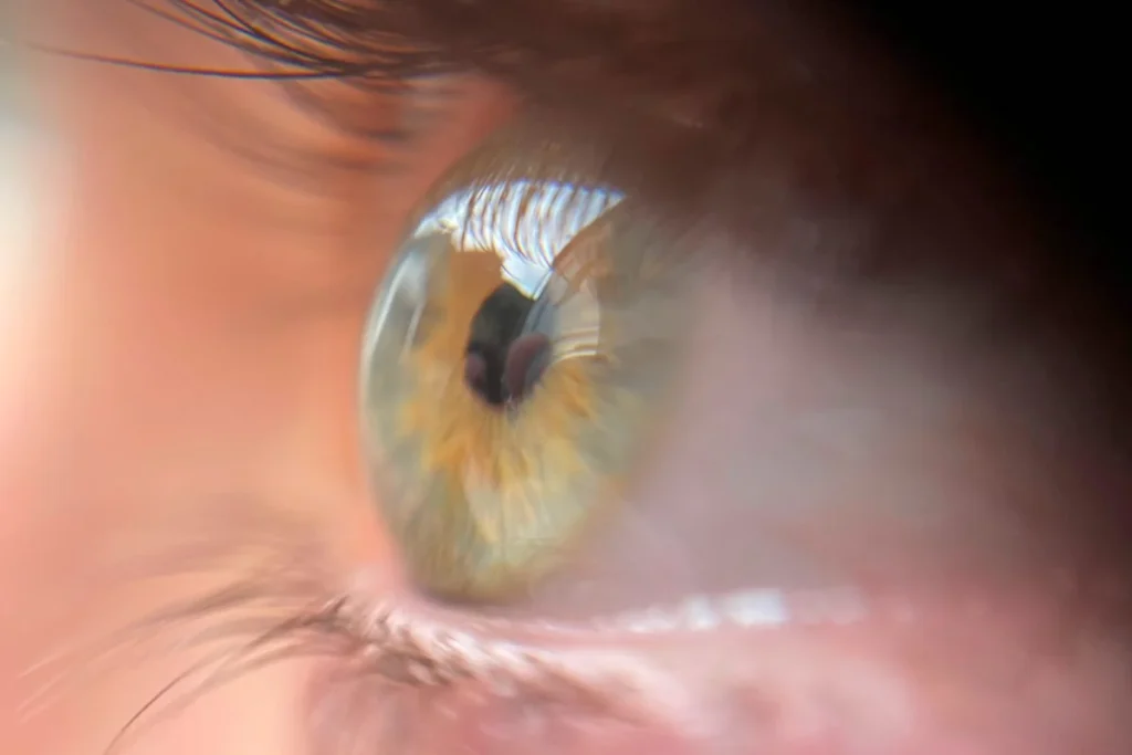 CONDICIONES OCULARES QUE PUEDEN PROVOCAR LA PÉRDIDA DE LA VISTA