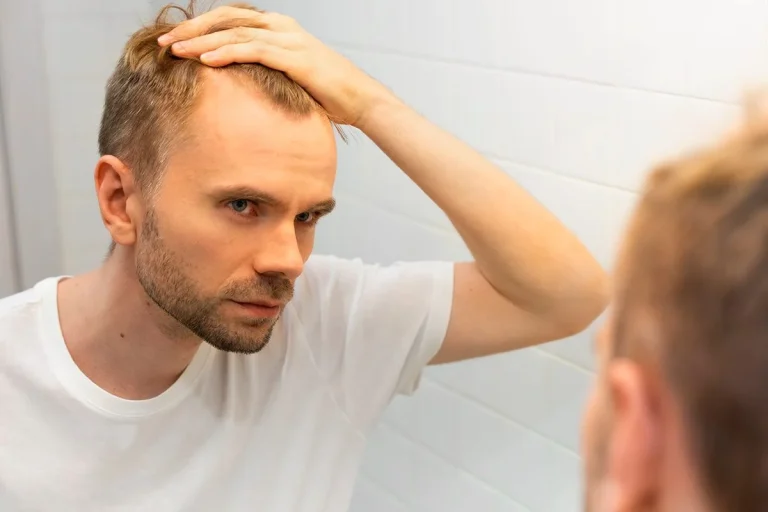 Científicos españoles consiguen revertir la alopecia gracias a una terapia con células madre