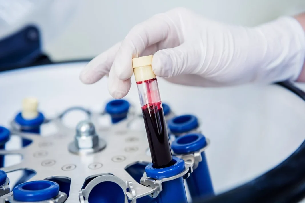 INNOVADOR MÉTODO DESARROLLADO EN JAPÓN