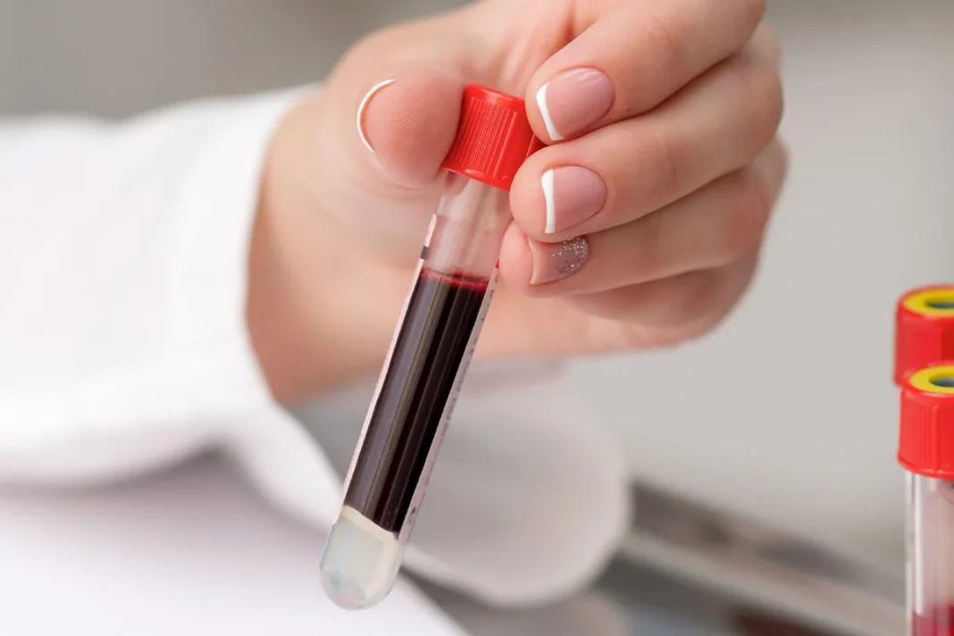 LAS VENTAJAS DE LA NUEVA SANGRE ARTIFICIAL CREADA EN JAPÓN