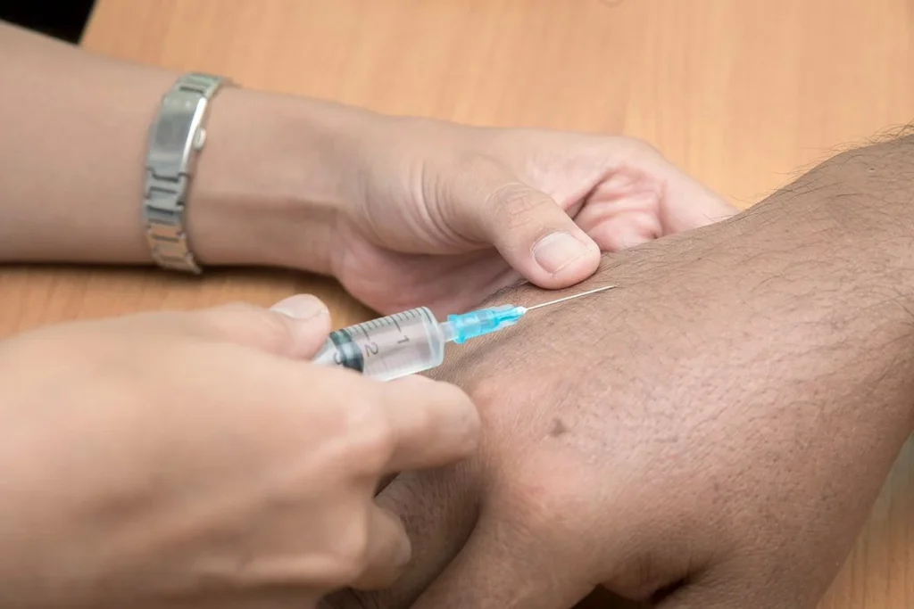 REVERSIBILIDAD DE ADAM