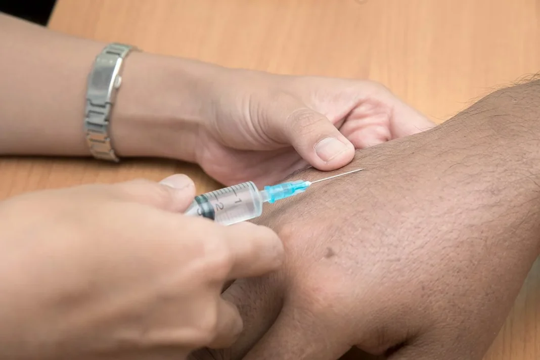 REVERSIBILIDAD DE ADAM