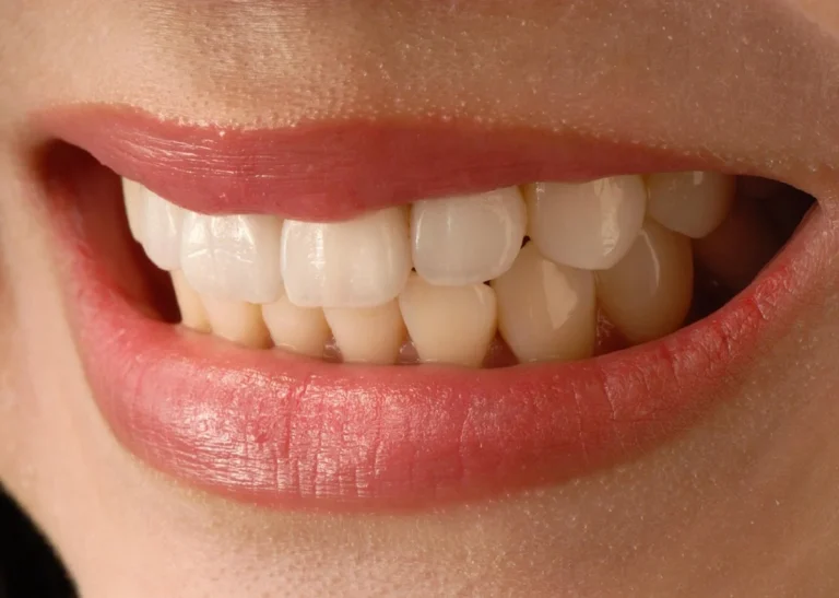 La era de la sonrisa consciente: por qué ahora cuidamos más la estética dental que nunca
