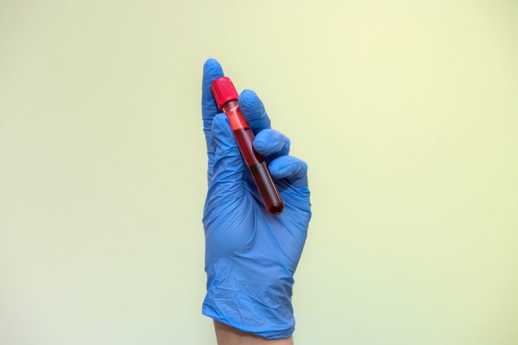 DISPONIBILIDAD DE LA SANGRE ARTIFICIAL EN POLVO