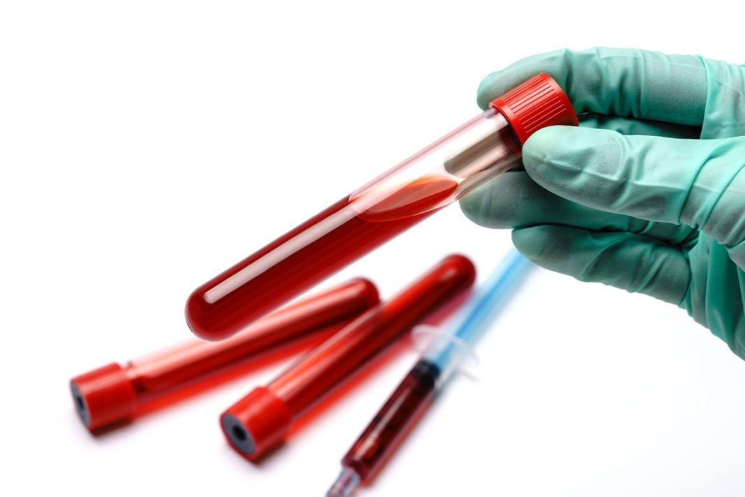 FABRICACIÓN DE SANGRE ARTIFICIAL EN POLVO