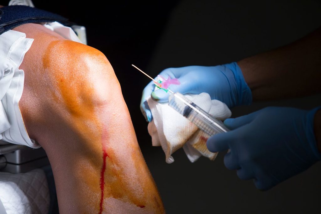 LA PIEL INYECTABLE ES UN GRAN AVANCE MÉDICO