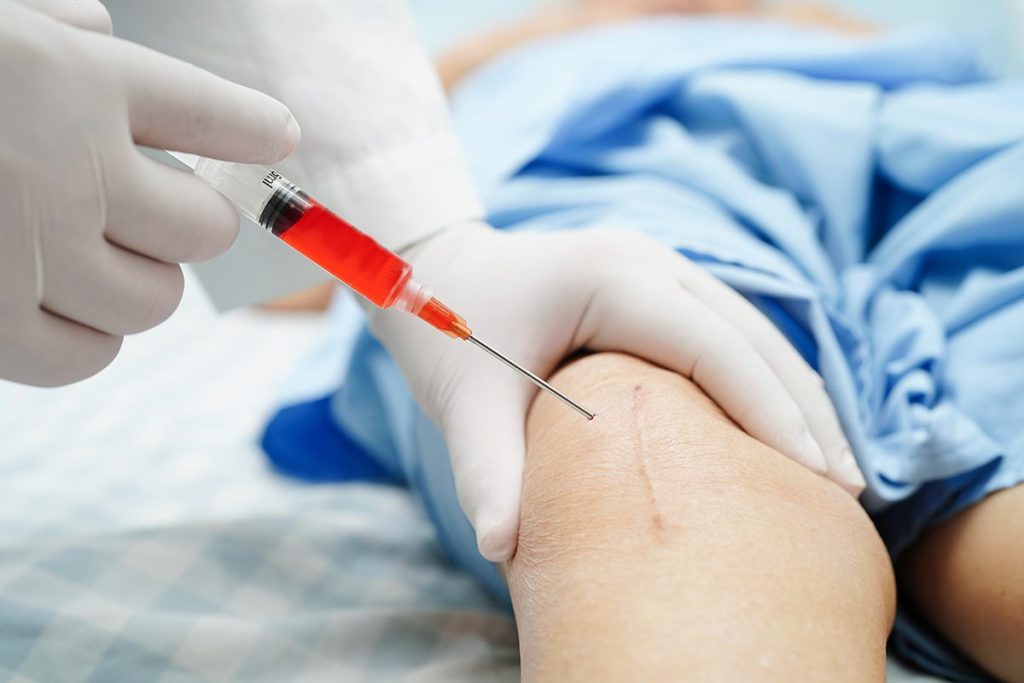 LA PIEL INYECTABLE ES UN MÉTODO PIONERO