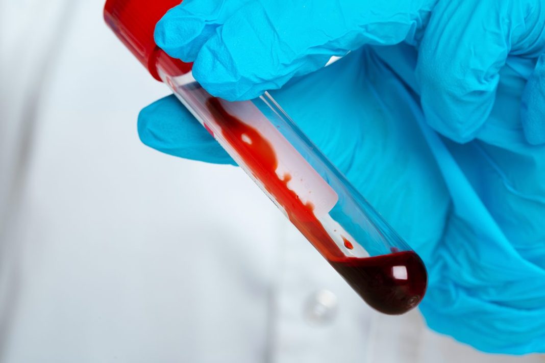 LA SANGRE ARTIFICIAL EN POLVO QUE PUEDE REVOLUCIONAR LA MEDICINA