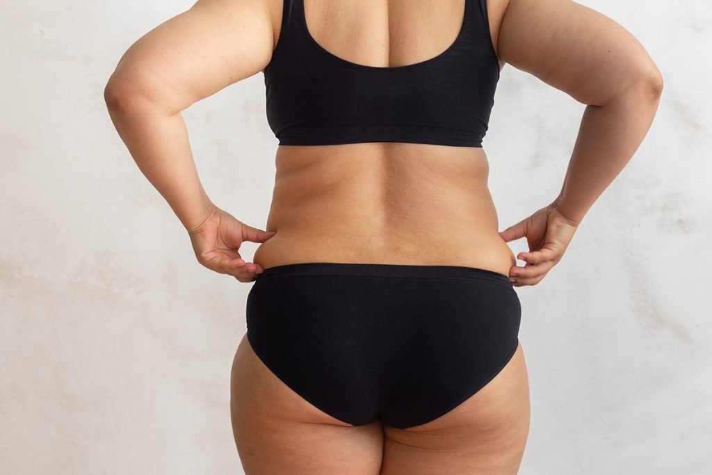 Una nueva inyección podría eliminar la grasa localizada sin cirugía 68 MÁS ALLÁ DE ELIMINAR LA GRASA LOCALIZADA