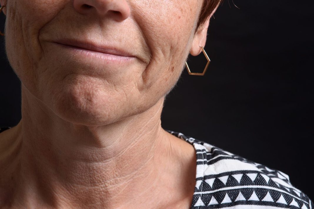 NUEVAS FORMAS DE TRATAR LAS ARRUGAS Y EL ENVEJECIMIENTO